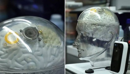 美媒详细介绍中国“脑机接口”技术进展：“起步晚美国20年，中国迅速赶上！”
