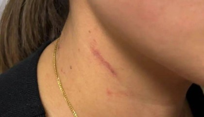 云南一男子酒后逼问妻子“是否出轨”并施暴，被警方行拘4日