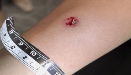 杭州警方通报：4名伤者均为女性