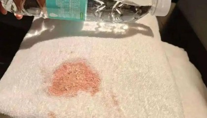 希岸酒店浴巾上出现大片血迹，到底是谁的责任？