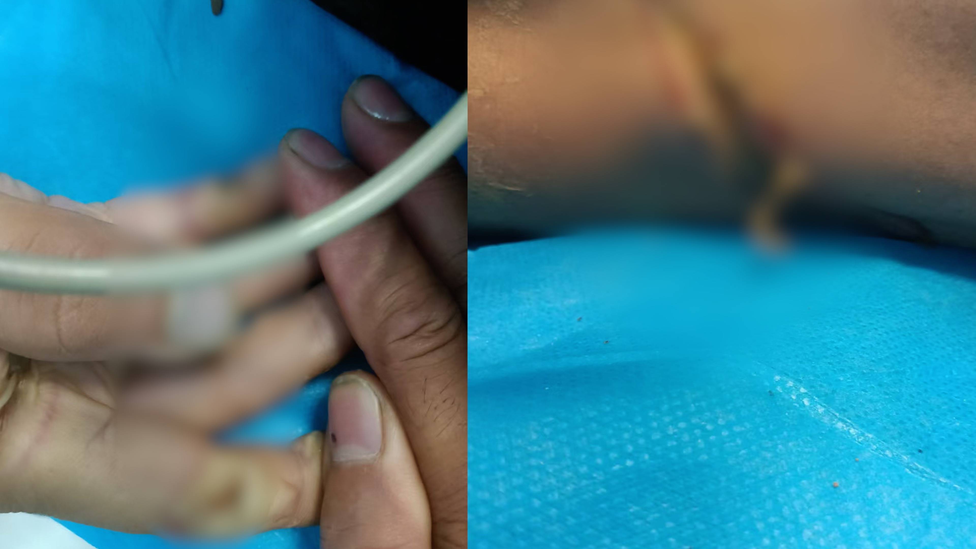 河南一对兄弟自家农田触电身亡,家属发声!当地:依法诉讼解决,绝不回避责任