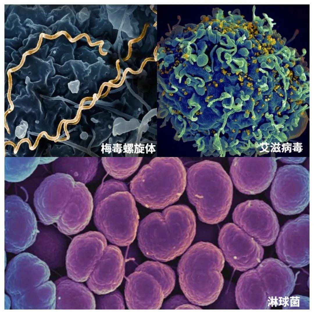 整个商场找不到一个蹲便，蹲厕真的比坐厕更卫生吗？为啥马桶越来越多？