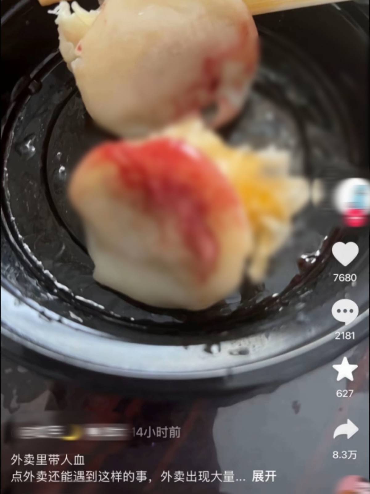 杭州一网友称外卖餐食中有血，自行就医并服用阻断药，市监人员：系店员手部受伤流的血，双方已和解